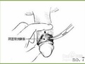 淮安包皮去哪家医院治***果好【图文详解包皮过程】