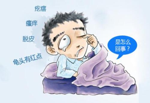 【包皮痒】男人不能忽视的包皮痒的原因!