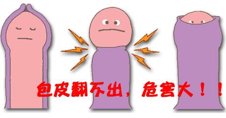 包皮上翻很疼什么原因  医生表示尽早诊断治疗！