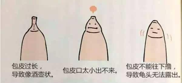 男人什么情况下才做包皮手术（真假区分）